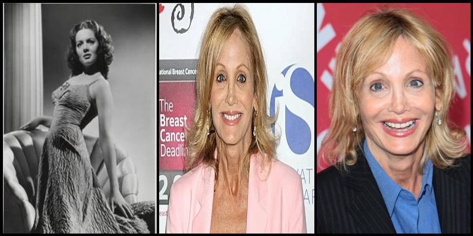 Famous People with name Arleen