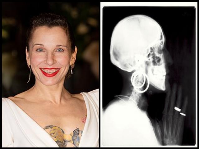 Famous People with name Meret